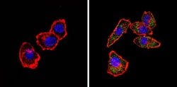 Invitrogen alpha-1a Adrenergic Receptor Polyclonal Antibody 100 &mu;L;