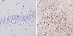 Invitrogen alpha-1a Adrenergic Receptor Polyclonal Antibody 100 &mu;L;