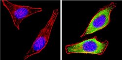Invitrogen Leptin Polyclonal Antibody 100 &mu;L; Unconjugated:Antibodies,