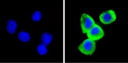 Invitrogen Leptin Polyclonal Antibody 100 &mu;L; Unconjugated:Antibodies,