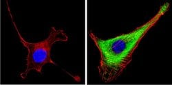 Invitrogen Leptin Polyclonal Antibody 100 &mu;L; Unconjugated:Antibodies,