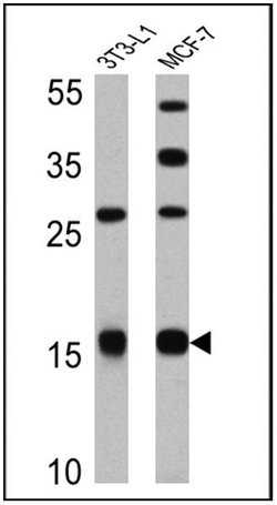 Invitrogen Leptin Polyclonal Antibody 100 &mu;L; Unconjugated:Antibodies,