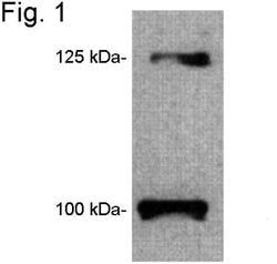 Invitrogen Leptin Receptor Polyclonal Antibody 100 &mu;L; Unconjugated:Antibodies,