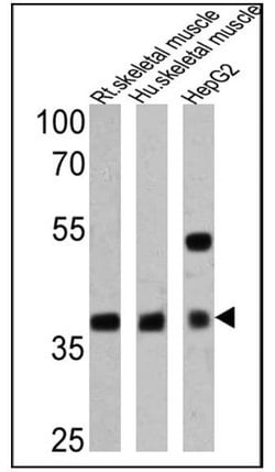 Invitrogen Adiponectin Receptor 1 Polyclonal Antibody 100 &mu;g; Unconjugated:Antibodies,
