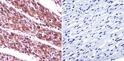 Invitrogen ARF6 Polyclonal Antibody:Antibodies:Primary Antibodies