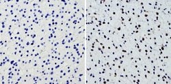 Invitrogen SOX2 Polyclonal Antibody:Antibodies:Primary Antibodies