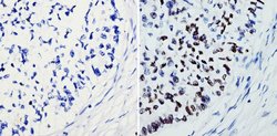 Invitrogen SOX2 Polyclonal Antibody:Antibodies:Primary Antibodies