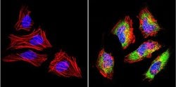 Invitrogen LIN28A Polyclonal Antibody 100 &mu;g; Unconjugated:Antibodies,