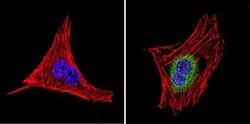 Invitrogen LIN28A Polyclonal Antibody 100 &mu;g; Unconjugated:Antibodies,