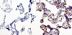 Invitrogen LIN28A Polyclonal Antibody 100 &mu;g; Unconjugated:Antibodies,