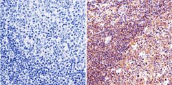 Invitrogen LIN28A Polyclonal Antibody 100 &mu;g; Unconjugated:Antibodies,