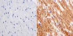 Invitrogen LIN28A Polyclonal Antibody 100 &mu;g; Unconjugated:Antibodies,