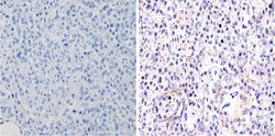 Invitrogen GATA4 Polyclonal Antibody:Antibodies:Primary Antibodies