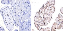 Invitrogen GATA4 Polyclonal Antibody:Antibodies:Primary Antibodies