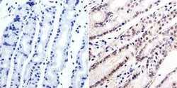 Invitrogen GATA6 Polyclonal Antibody:Antibodies:Primary Antibodies