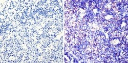 Invitrogen PAX5 Polyclonal Antibody 100 &mu;g; Unconjugated:Antibodies,