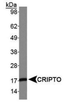 Cripto Rabbit anti-Human, Polyclonal, Invitrogen 100 &mu;L | Buy Online | Invitrogen | Fisher Scientific