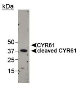 Invitrogen CYR61 Polyclonal Antibody 100 &mu;L; Unconjugated:Antibodies