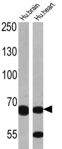 Invitrogen ADAMTS5 Polyclonal Antibody 100 &mu;g; Unconjugated:Antibodies,