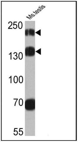 Invitrogen PSME4 Polyclonal Antibody 100 &mu;L; Unconjugated:Antibodies,