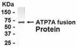 ATP7A, Polyclonal, Invitrogen 50&mu;g; Unconjugated:Antibodies, Polyclonal