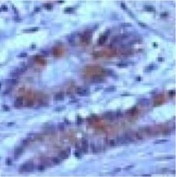 Protein APC, Polyclonal, Invitrogen 500 &mu;L | Buy Online | Thermo Scientific | Fisher Scientific