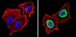 Invitrogen THRA Polyclonal Antibody 100 &mu;L | Buy Online | Invitrogen&trade; | Fisher Scientific
