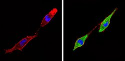 Invitrogen THRA Polyclonal Antibody 100 &mu;L | Buy Online | Invitrogen&trade; | Fisher Scientific