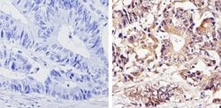 Invitrogen THRA Polyclonal Antibody 100 &mu;L | Buy Online | Invitrogen&trade; | Fisher Scientific
