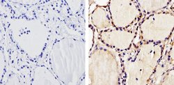 Invitrogen THRA Polyclonal Antibody 100 &mu;L | Buy Online | Invitrogen&trade; | Fisher Scientific