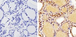 Invitrogen THRA Polyclonal Antibody 100 &mu;L | Buy Online | Invitrogen&trade; | Fisher Scientific