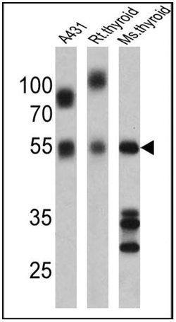 Invitrogen THRA Polyclonal Antibody 100 &mu;L | Buy Online | Invitrogen&trade; | Fisher Scientific