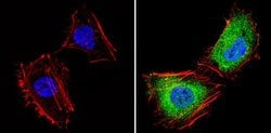 Invitrogen THRB Polyclonal Antibody 100 &mu;L; Unconjugated:Antibodies,