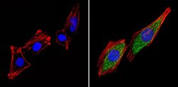 Invitrogen THRB Polyclonal Antibody 100 &mu;L; Unconjugated:Antibodies,