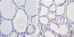 Invitrogen THRB Polyclonal Antibody 100 &mu;L; Unconjugated:Antibodies,