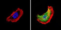 Invitrogen THRA Polyclonal Antibody 200 &mu;g; Unconjugated:Antibodies,