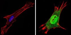 Invitrogen THRA Polyclonal Antibody 200 &mu;g; Unconjugated:Antibodies,