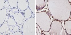 Invitrogen THRA Polyclonal Antibody 200 &mu;g; Unconjugated:Antibodies,