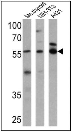 Invitrogen THRA Polyclonal Antibody 200 &mu;g; Unconjugated:Antibodies,