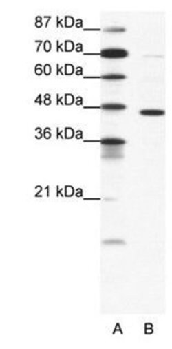 GABRP Polyclonal Antibody, Invitrogen 100 &mu;g | Buy Online | Thermo Scientific | Fisher Scientific