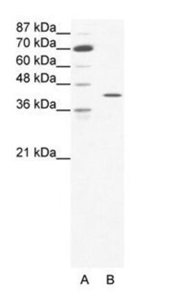 c-Fos Polyclonal Antibody, Invitrogen 100 &mu;g; Unconjugated:Antibodies,
