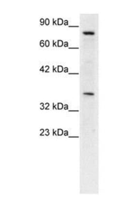 NPAS1 Polyclonal Antibody, Invitrogen 50 &mu;g | Buy Online | Invitrogen | Fisher Scientific