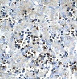 SCD Polyclonal Antibody, Invitrogen 100 &mu;g | Buy Online | Thermo Scientific | Fisher Scientific