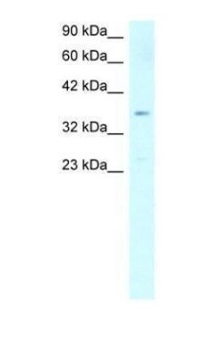 SCD Polyclonal Antibody, Invitrogen 100 &mu;g | Buy Online | Thermo Scientific | Fisher Scientific