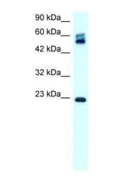 Claudin 8 Polyclonal Antibody, Invitrogen 100 &mu;g | Buy Online | Thermo Scientific | Fisher Scientific