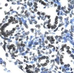 Claudin 17 Polyclonal Antibody, Invitrogen 100 &mu;g; Unconjugated:Antibodies,