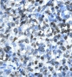 Claudin 17 Polyclonal Antibody, Invitrogen 100 &mu;g; Unconjugated:Antibodies,