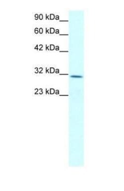 Claudin 17 Polyclonal Antibody, Invitrogen 100 &mu;g; Unconjugated:Antibodies,