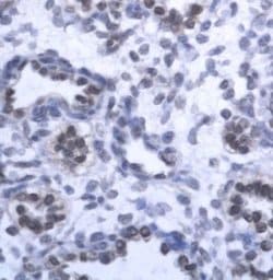 GAS41 Polyclonal Antibody, Invitrogen 50 &mu;g; Unconjugated:Antibodies,