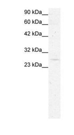 GAS41 Polyclonal Antibody, Invitrogen 50 &mu;g; Unconjugated:Antibodies,